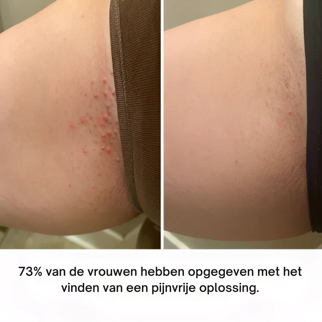 TrimEase™ Mini – Draadloze Precisietrimmer voor Vrouwen