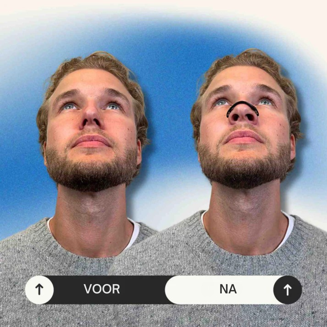 AirEase Max – Neusclip tegen Snurken & Voor Vrije Ademhaling