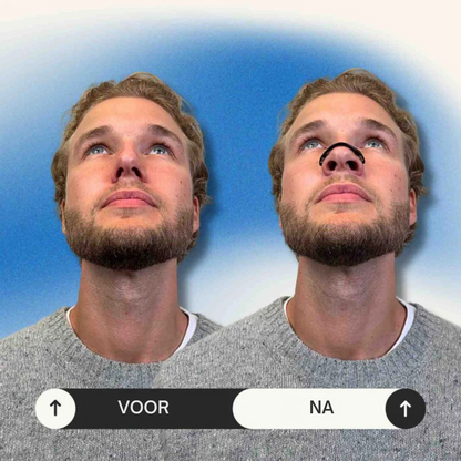 AirEase Max – Neusclip tegen Snurken & Voor Vrije Ademhaling