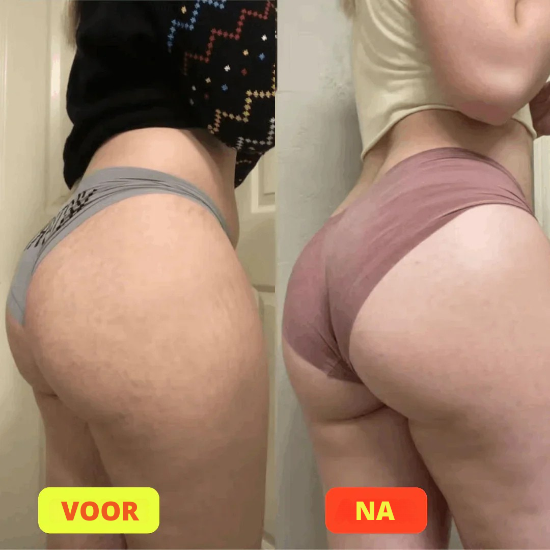 GlutePro™ Max – Booty Trainer voor Strakkere & Sterkere Billen