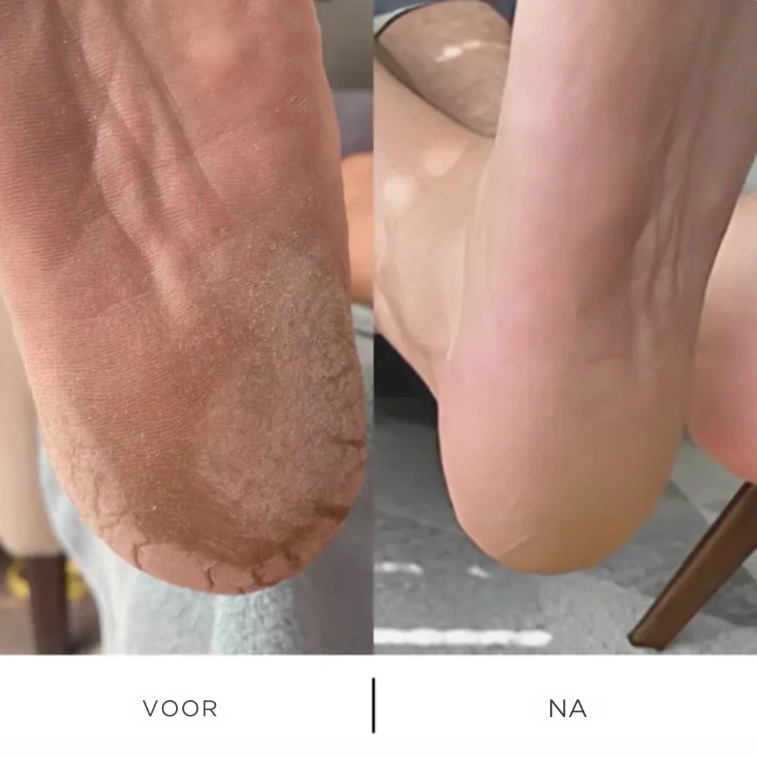 VelvetFeet™ Pro – Elektrische Eeltvijl voor Zachte & Gladde Voeten