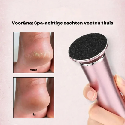 VelvetFeet™ Pro – Elektrische Eeltvijl voor Zachte & Gladde Voeten