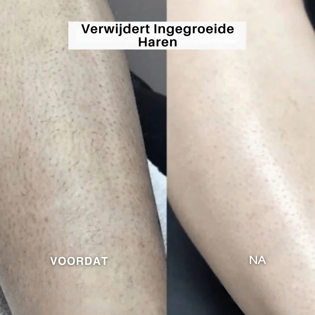 SilkGroom™ 5-in-1 – Pijnloos Scheerapparaat voor Zijdezachte Huid