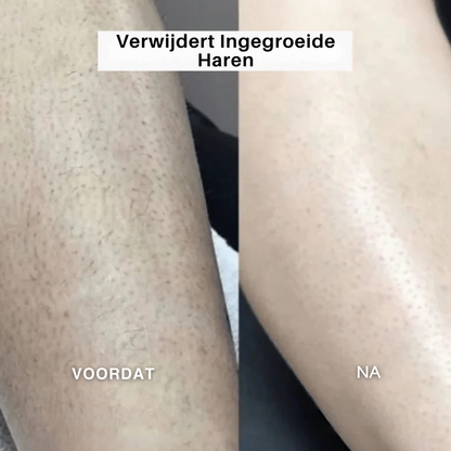 SilkGroom™ 5-in-1 – Pijnloos Scheerapparaat voor Zijdezachte Huid
