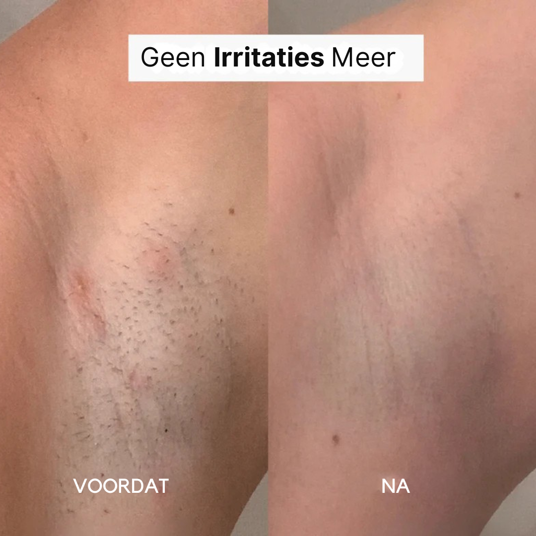 SilkGroom™ 5-in-1 – Pijnloos Scheerapparaat voor Zijdezachte Huid